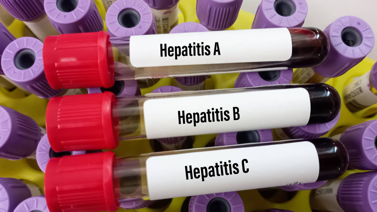 Laboratorion näyteputkia, joissa teksti hepatiitti A, B ja C.